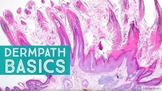 Basic Dermpath Cases  - Explained by a Dermatopathologist