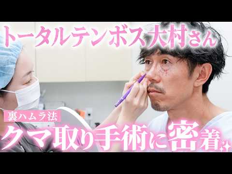 [Under-Eye Dark Circle Treatment] A Behind-the-Scenes Look at Omura from Total Ten Bosch's Surger...