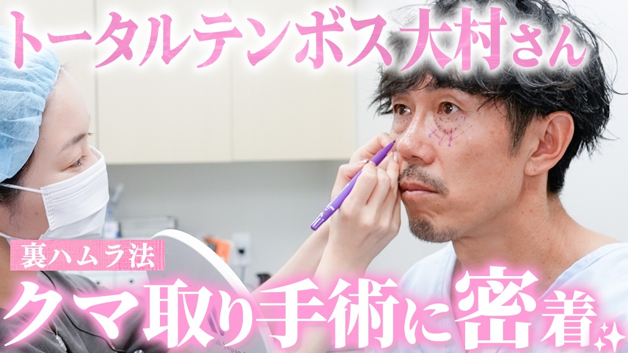 【目の下のクマ治療】トータルテンボス大村さんの手術に密着｜術後経過も公開