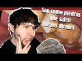 🦷😖Así se RETIRA el SARRO DENTAL (tártaro o calculo), 😫🦷 reaccionando a compilado de DESTARTRAJES N°1