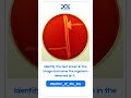 Spotter of the Day 🔬 | Identify the Test & Organism | MBBS Microbiology Challenge