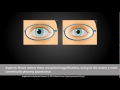 Spherical vs Aspherical Lenses  -   for Eyewear Glasses