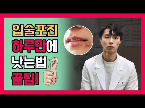 치과의약사가 알려주는 헤르페스 입술포진 빨리 낫는법과 원인~이렇게해보세요  (feat 아시클로버, 발라시클로버)