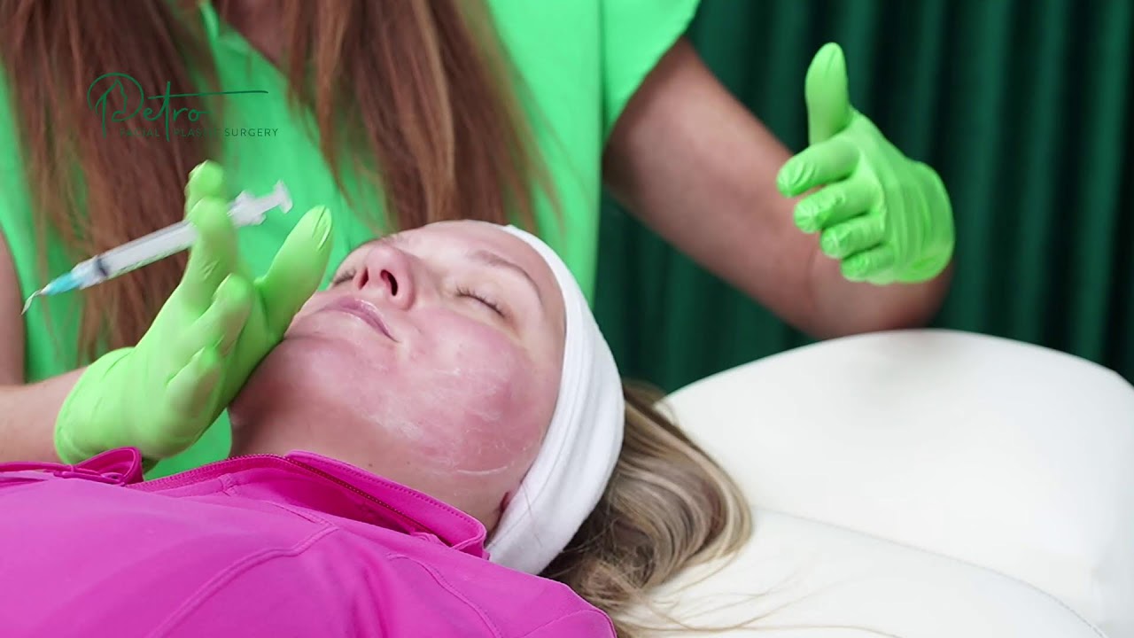 Microneedling Peptide Infusion