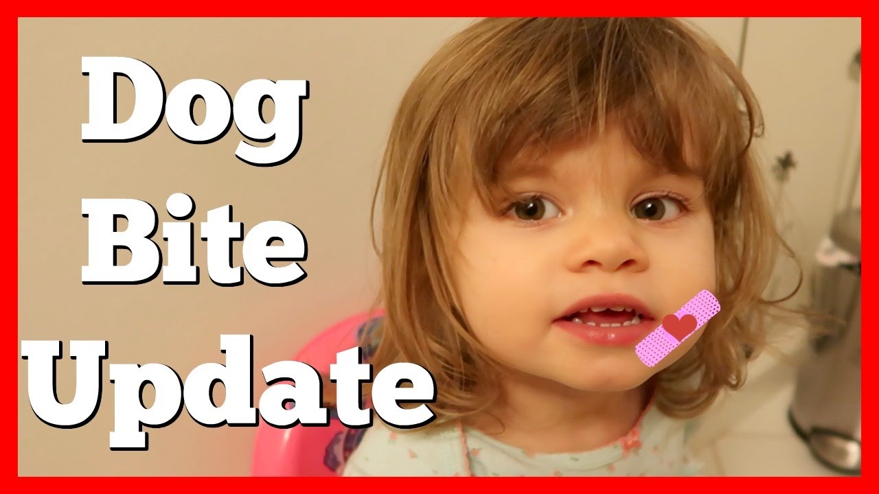 DOG BITE UPDATE YouTube