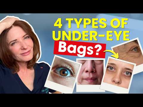 Identifying This Will Get Rid Your Your Eye Bags