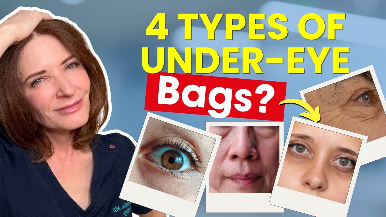 Identifying This Will Get Rid Your Your Eye Bags
