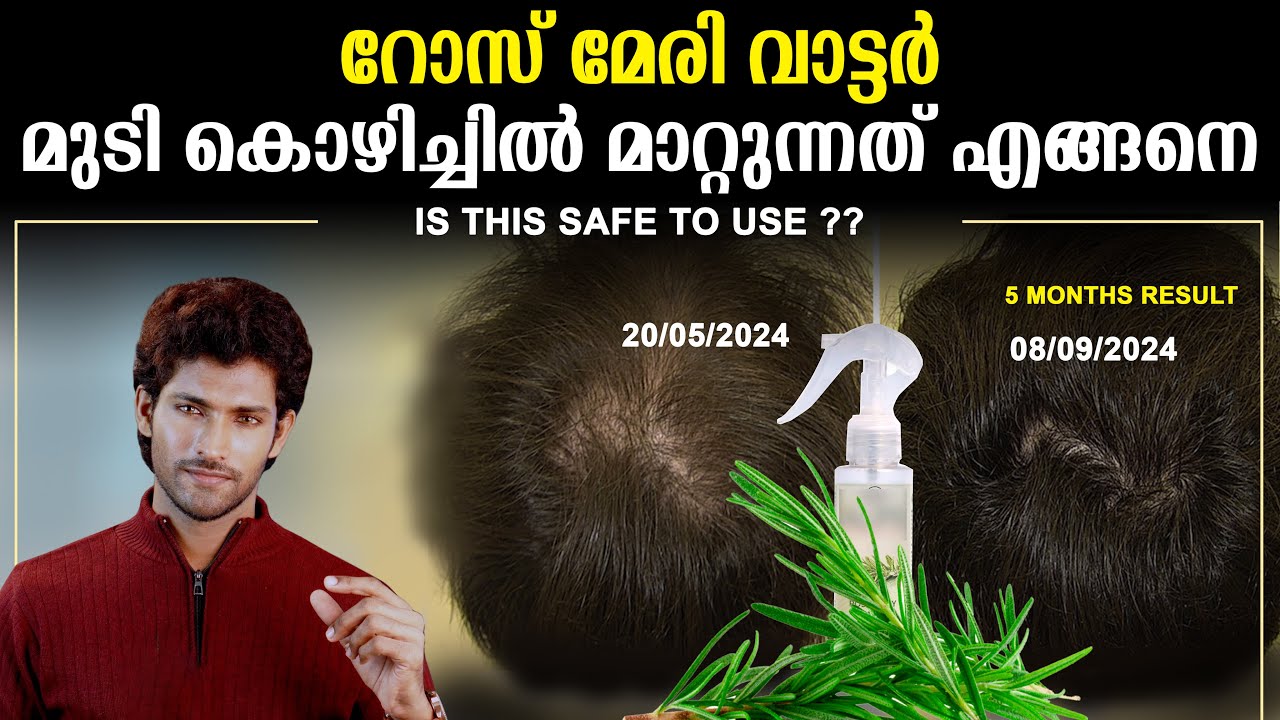 റോസ്മേരി വാട്ടർ ഉപയോഗിക്കുന്ന ആളുകൾ തീർച്ചയായും അറിഞ്ഞിരിക്കണം | ROSEMARY WATER