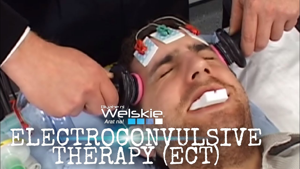 Electroconvulsive therapy machine – Show.Me