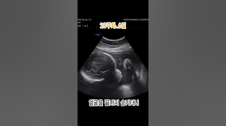 심장이 쿵…우리 아기 처음 만난 날 #태아 #입체초음파 #임신