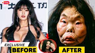 20 Celebrities With the Most Controversial Plastic Surgery Transformations