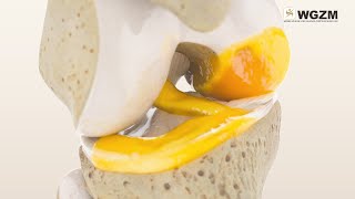 Wgzm - Mibrar Rrggs Ru