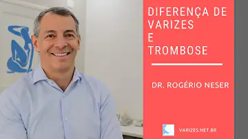 Qual a diferença entre a trombose e varizes?