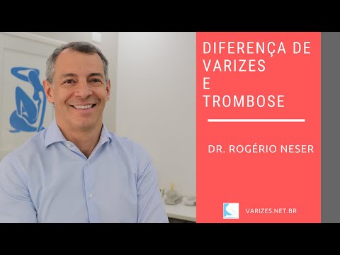 Vídeo: Diferença Entre Trombose Venosa Profunda E Veias Varicosas