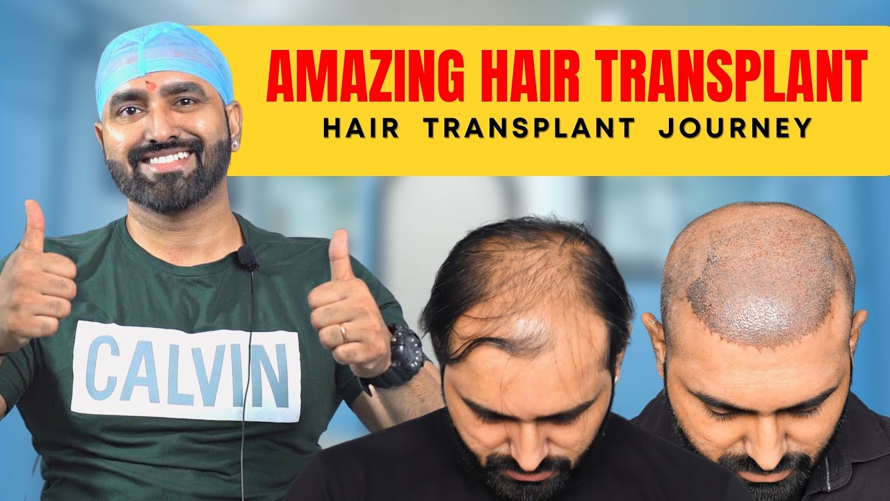Discover more than 58 hair transplant in jabalpur latest in.eteachers