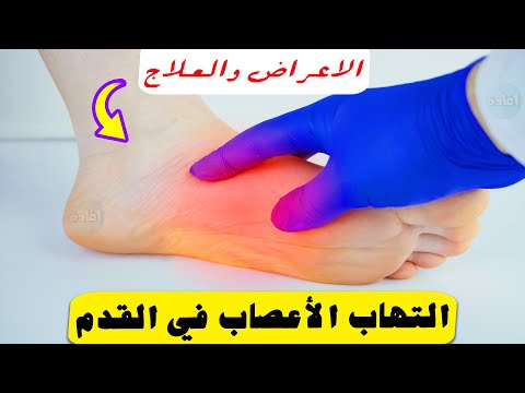 أعراض التهاب الأعصاب في القدم