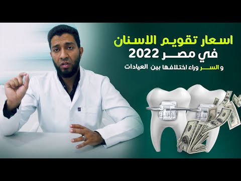 اسعار تقويم الاسنان في مصر 2022 و السر وراء إختلافها بين العيادات | د/ مصطفى الشيتي