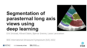 Segmentation of parasternal long axis views using deep learning