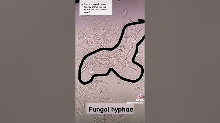 Yeast cells and Fungal hyphae seen on Vaginal swab sample under the microscope #microscope #yeast