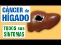 Todos los Síntomas del Cáncer de Hígado