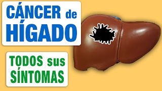 Todos los Síntomas del Cáncer de Hígado