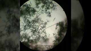 Cladosporium sp images (10x and plate)