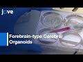 Forebrain-type Cerebral Organoids Generated from hiPSCs | Protocol Preview