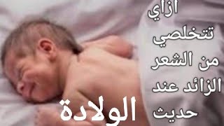 حديث الولادة المشعر والحل السحري علشان نتخلص منه والأسباب?