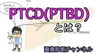 医療用語のPTCD(PTBD)とは？図を用いてわかりやすく解説！