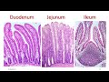 Histology of Duodenum, Jejunum & Ileum