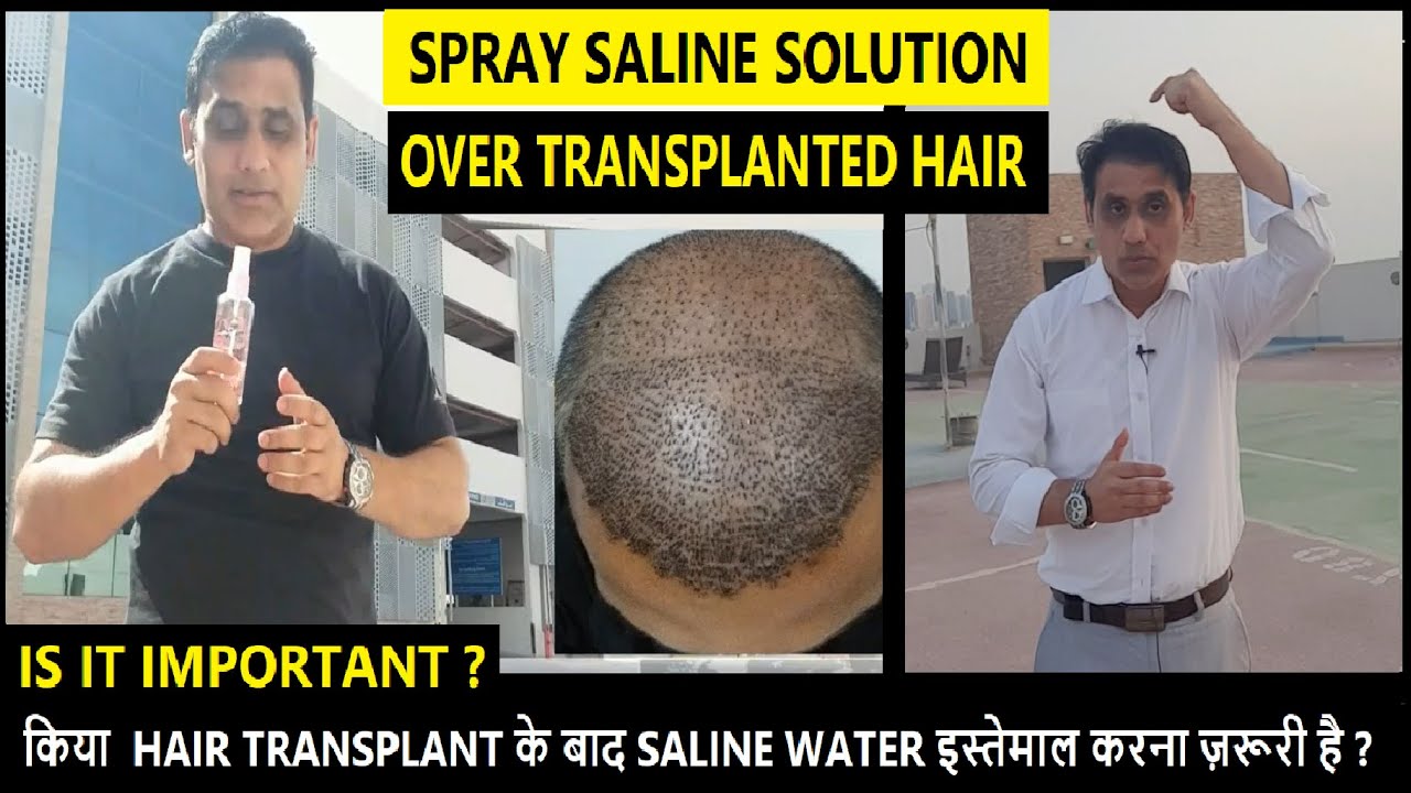 Is It Important To Spray Saline Water/Solution After Hair Transplant