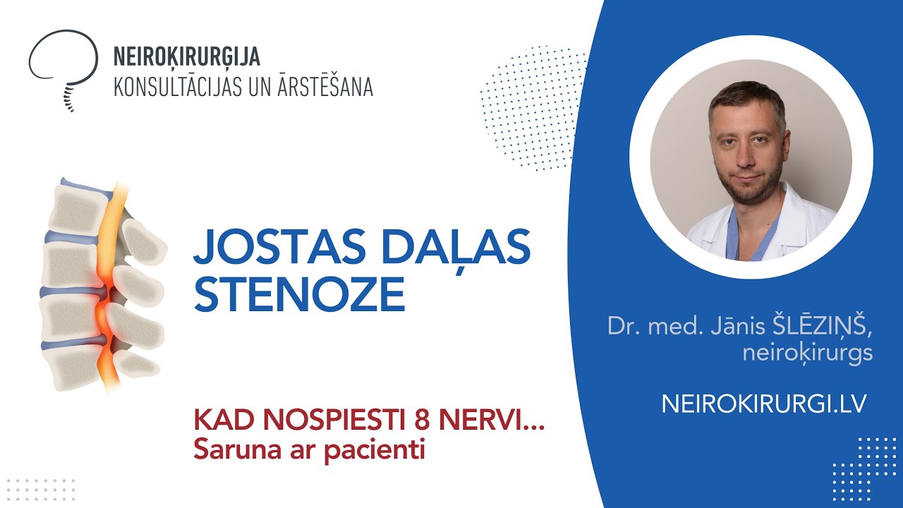 Smaga izvēle! Pacientei bija nospiesti astoņi mugurkaula nervi.