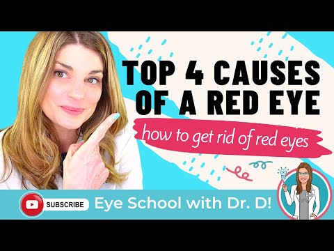 Video: Why Does Red Eye Occur?