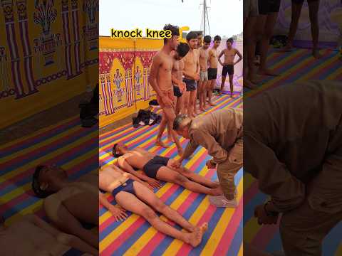 knock knee test