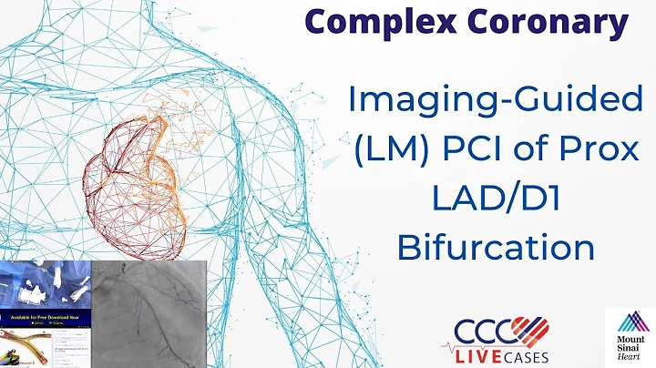Imaging-Guided (LM) PCI of Prox LAD/D1 Bifurcation