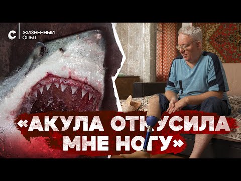 «Вместо ноги только кость торчит». Пережил нападение акулы