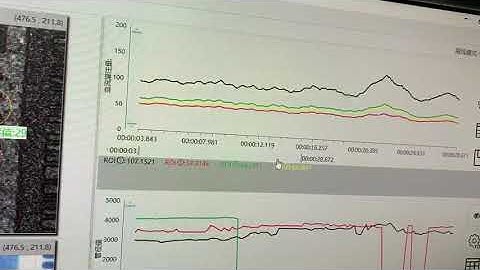 RWD Laser Speckle Imaging system can check the blood flows size through the pseudo-color map