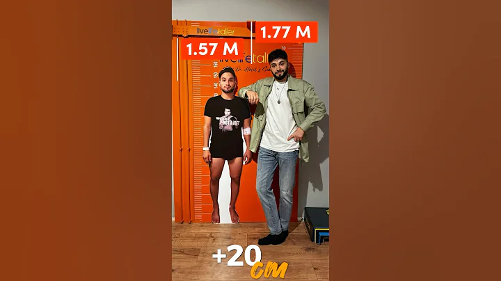 Sedat, the King of #limblengtheningsurgery gained worldwide fame. With a record extension of 20 cm