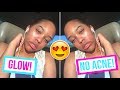 THE KEY TO CLEAR &amp; GLOWING SKIN!! ✨| COLLAB!
