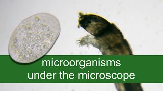 Microorganisms under the MICROSCOPE #2 // invisible world