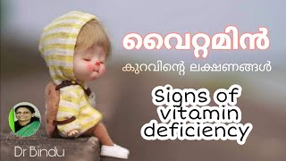 വൈറ്റമിൻ കുറവിന്റെ ലക്ഷണങ്ങൾ കുട്ടിയ്ക്കുണ്ടോ/what are the signs of vitamin deficiency/Dr Bindu screenshot 3