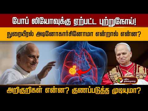 போப் லியோவுக்கு ஏற்பட்ட புற்றுநோய்! நுரையீரல் அடினோகார்சினோமா என்றால் என்ன? | PTD