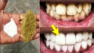خلطات تبيض الاسنان $  وصفة مجربة ️تبييض الاسنان مثل اللؤلؤ وإزالة الاسفرار والجير/العلاج في المنزل