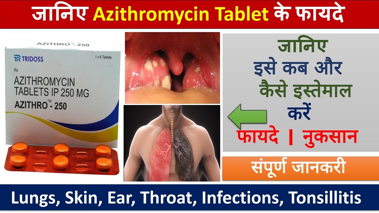 Azithromycin Tablet - Uses, Side Effects, Dosage, Precautions, Price ...