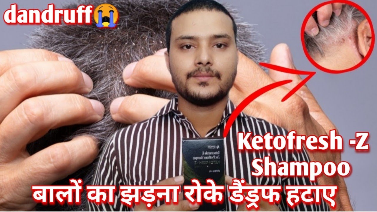 Ketofresh z shampooanti dandruff shampooketoconazole shampoo uses in hindiKetofresh