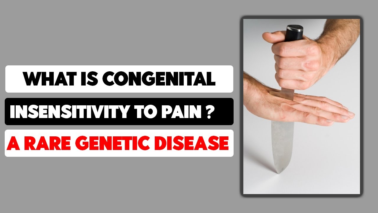 What is Congenital insensitivity to pain? A Rare Genetic Disease - YouTube