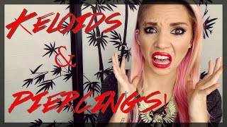 Piercings: Keloids & Hypertrophic Scarring!