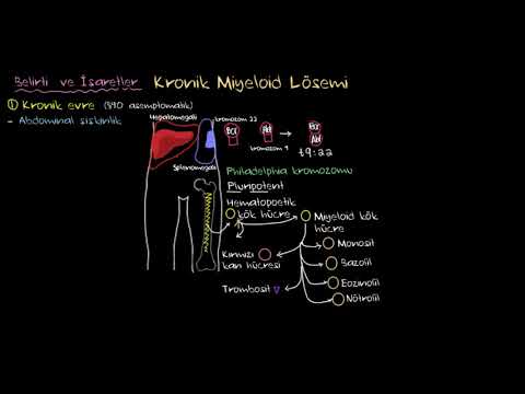 Kronik Miyeloid Lösemi (KML) Nedir? (Sağlık Bilgisi ve Tıp)