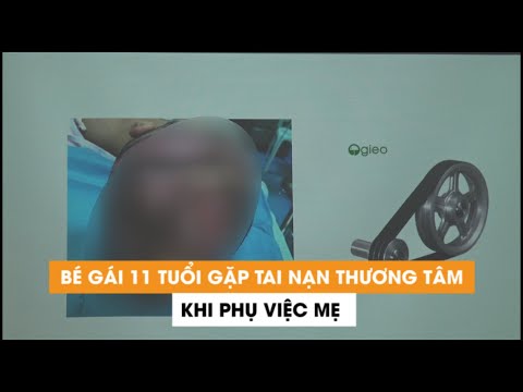 Video Phụ việc mẹ, bé gái 11 tuổi gặp nạn thương tâm, bị lóc... - youtube