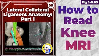 (Fig 3-B.05) Lateral Collateral Ligament Anatomy: Part 1
